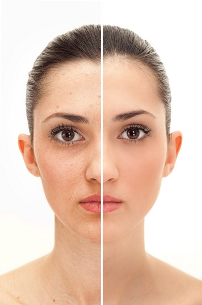 woman's face, beauty concept before and after contrast,  power of retouch